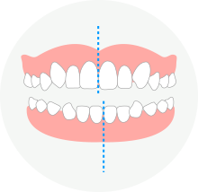 偏位(顎・骨格・歯のズレ)の矯正例｜神戸三宮・元町の大塚矯正歯科